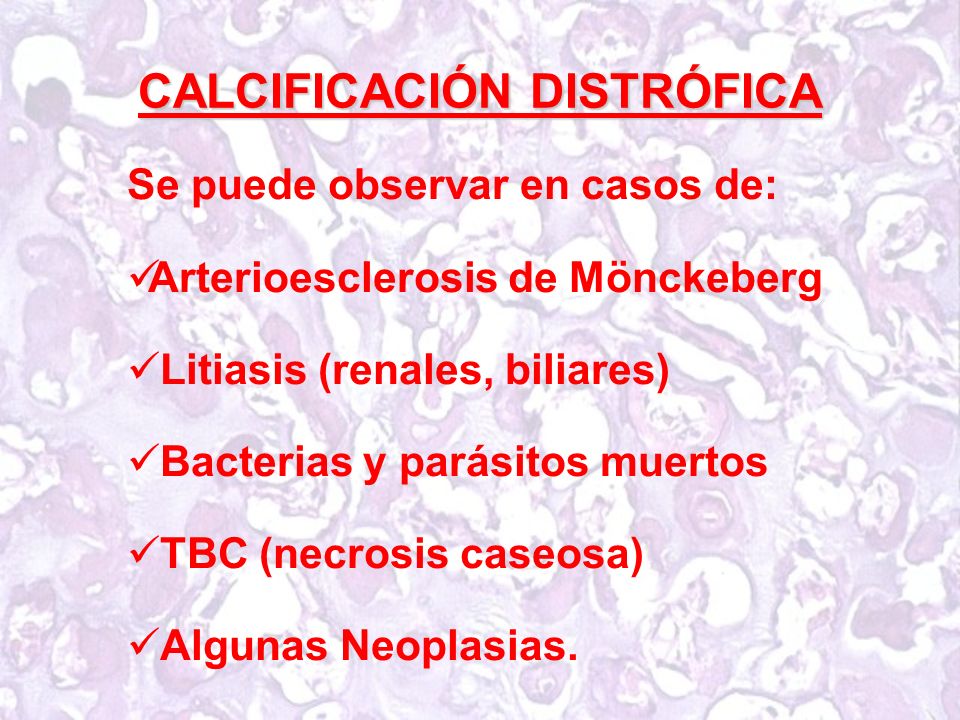 Patogénesis de calcificación distrófica de la hipertensión